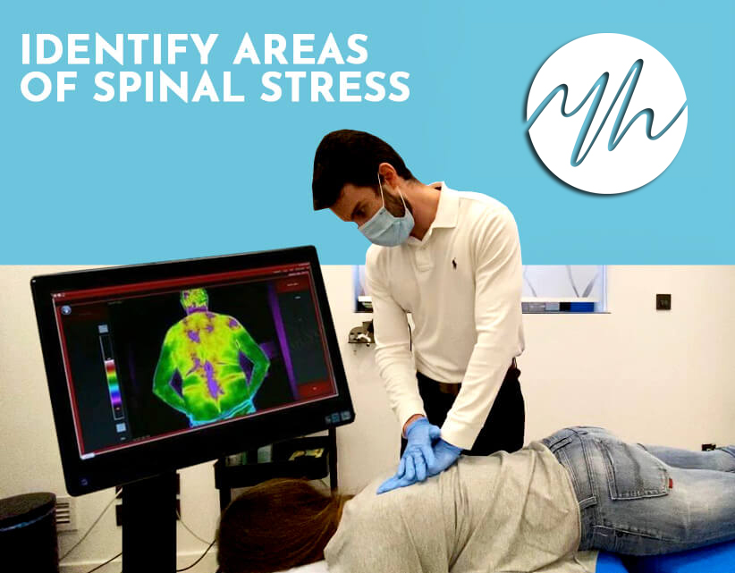 Identify Areas of Spinal Stress