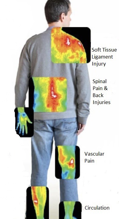 Thermography Body