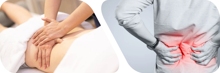 Physiotherapy Sciatica